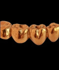 Custom Gold Grill