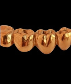 Custom Gold Grill